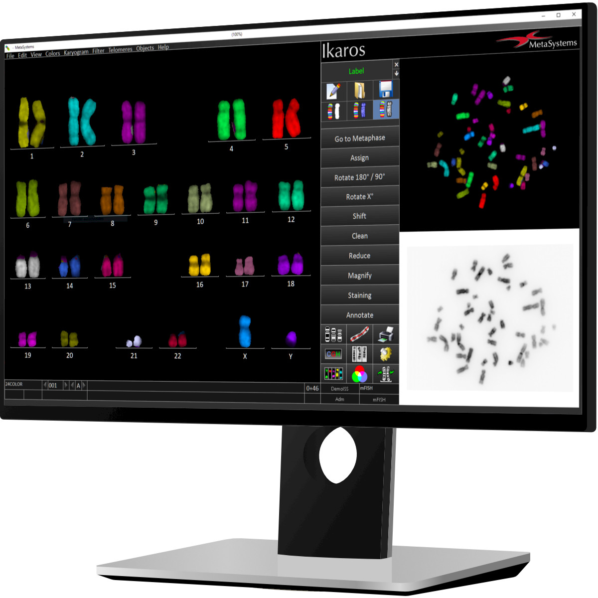 A monitor displaying strands